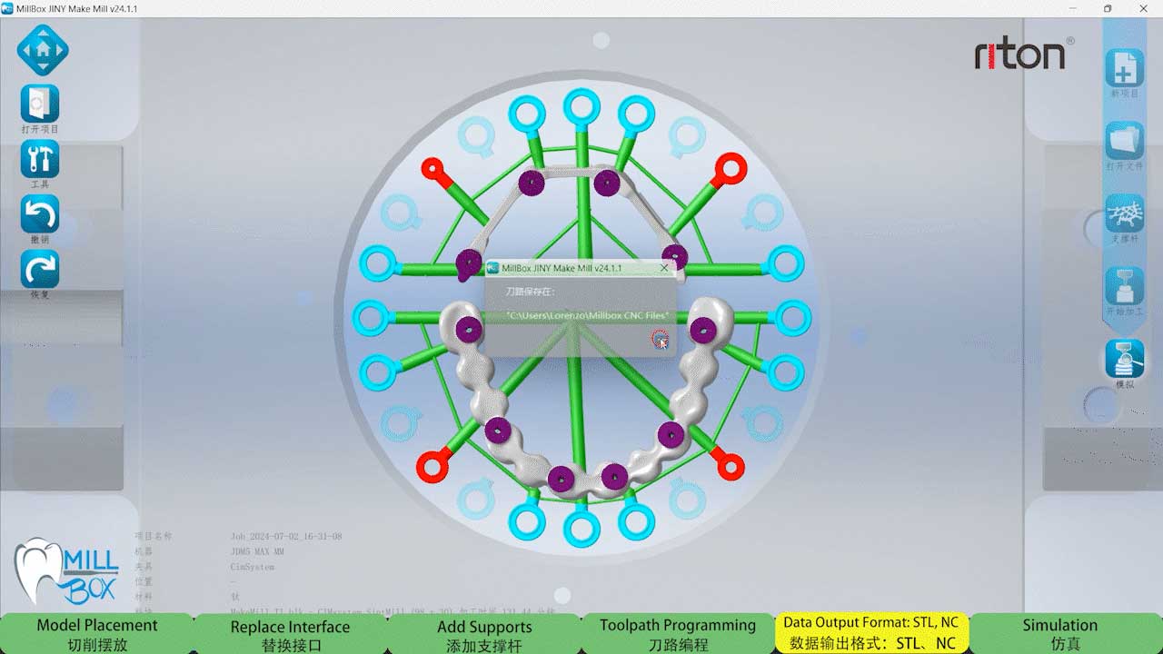 after importing the matching parameter data after importing the matching parameter data