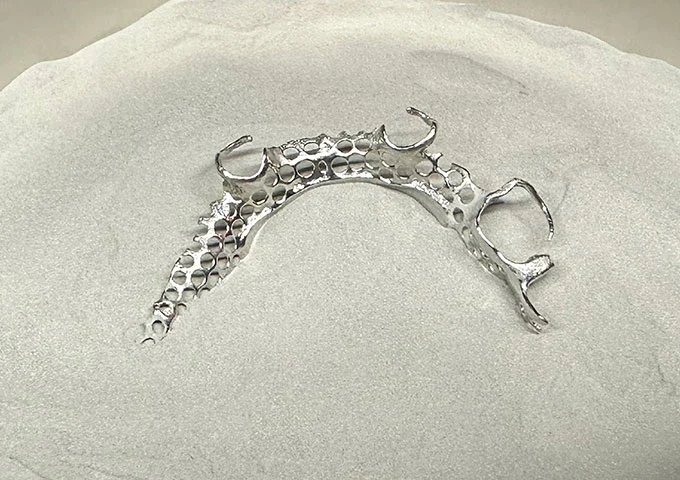 Analysis of the Global Market Application of Dental Alloy Materials Analysis of the Global Market Application of Dental Alloy Materials